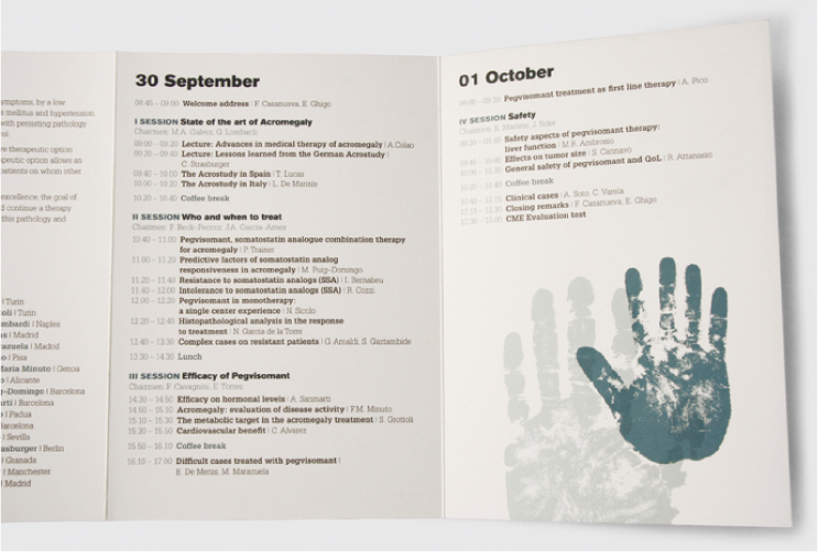 acromegaly3